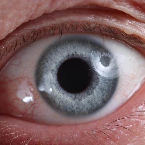 Closeup Of Healthy Eye With Detailed Iris